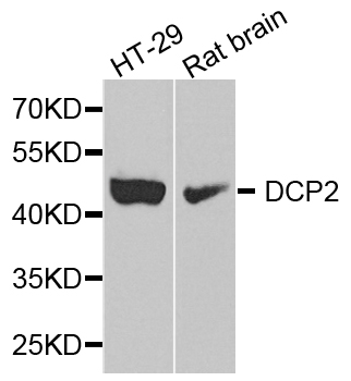 DCP2 Antibody - Western blot analysis of extract of various cells.