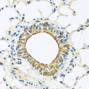 DCP2 Antibody - Immunohistochemistry of paraffin-embedded mouse lung tissue.