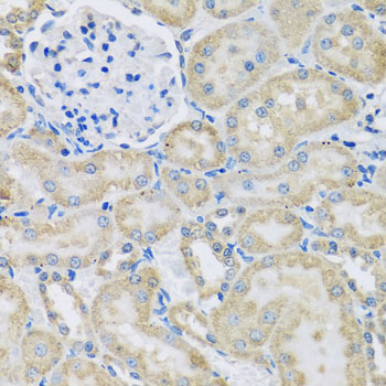 DCP2 Antibody - Immunohistochemistry of paraffin-embedded rat kidney tissue.