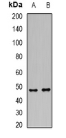 DCP2 Antibody - Western blot analysis of DCP2 expression in HT29 (A); rat brain (B) whole cell lysates.
