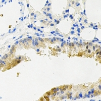 DCP2 Antibody - Immunohistochemical analysis of DCP2 staining in mouse lung formalin fixed paraffin embedded tissue section. The section was pre-treated using heat mediated antigen retrieval with sodium citrate buffer (pH 6.0). The section was then incubated with the antibody at room temperature and detected using an HRP conjugated compact polymer system. DAB was used as the chromogen. The section was then counterstained with hematoxylin and mounted with DPX.