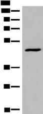 DCP2 Antibody - Western blot analysis of HL-60 cell lysate  using DCP2 Polyclonal Antibody at dilution of 1:500