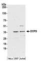 DCPS Antibody - Detection of human DCPS by western blot. Samples: Whole cell lysate (50 µg) from HeLa, HEK293T, and Jurkat cells prepared using NETN lysis buffer. Antibody: Affinity purified rabbit anti-DCPS antibody used for WB at 0.1 µg/ml. Detection: Chemiluminescence with an exposure time of 3 minutes.