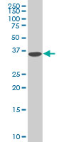 DCPS Antibody - DCPS monoclonal antibody (M02), clone 1G4 Western blot of DCPS expression in HeLa.