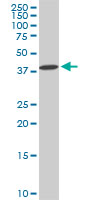 DCPS Antibody - DCPS monoclonal antibody (M02), clone 1G4. Western blot of DCPS expression in PC-12.