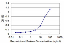 DCPS Antibody - Detection limit for recombinant GST tagged DCPS is approximately 3 ng/ml as a capture antibody.