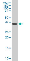 DCPS Antibody - DCPS monoclonal antibody (M03), clone 3E5 Western blot of DCPS expression in HeLa.