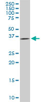 DCPS Antibody - DCPS monoclonal antibody (M03), clone 3E5. Western blot of DCPS expression in PC-12.