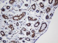 DCPS Antibody - IHC of paraffin-embedded Human breast tissue using anti-DCPS mouse monoclonal antibody.