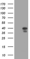 DCPS Antibody - HEK293T cells were transfected with the pCMV6-ENTRY control (Left lane) or pCMV6-ENTRY DCPS (Right lane) cDNA for 48 hrs and lysed. Equivalent amounts of cell lysates (5 ug per lane) were separated by SDS-PAGE and immunoblotted with anti-DCPS.