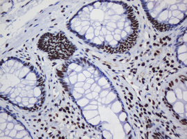 DCPS Antibody - IHC of paraffin-embedded Human colon tissue using anti-DCPS mouse monoclonal antibody.