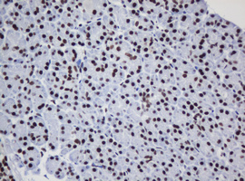 DCPS Antibody - IHC of paraffin-embedded Human pancreas tissue using anti-DCPS mouse monoclonal antibody.