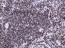DCPS Antibody - IHC of paraffin-embedded Human lymph node tissue using anti-DCPS mouse monoclonal antibody.