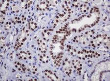 DCPS Antibody - IHC of paraffin-embedded Human Kidney tissue using anti-DCPS mouse monoclonal antibody.