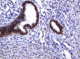 DCPS Antibody - IHC of paraffin-embedded Human endometrium tissue using anti-DCPS mouse monoclonal antibody.