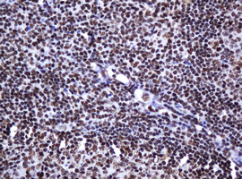 DCPS Antibody - IHC of paraffin-embedded Human tonsil using anti-DCPS mouse monoclonal antibody.