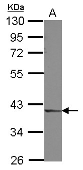 DCPS Antibody - Sample (30 ug of whole cell lysate) A: A549 10% SDS PAGE DCPS antibody diluted at 1:3000