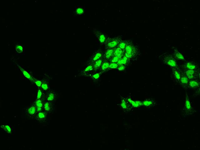 DCPS Antibody - Immunofluorescence staining of DCPS in A431 cells. Cells were fixed with 4% PFA, permeabilzed with 0.1% Triton X-100 in PBS, blocked with 10% serum, and incubated with rabbit anti-Human DCPS polyclonal antibody (dilution ratio 1:200) at 4°C overnight. Then cells were stained with the Alexa Fluor 488-conjugated Goat Anti-rabbit IgG secondary antibody (green). Positive staining was localized to Nucleus.