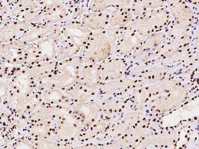 DCPS Antibody - Immunochemical staining of human DCPS in human kidney with rabbit polyclonal antibody at 1:1000 dilution, formalin-fixed paraffin embedded sections.