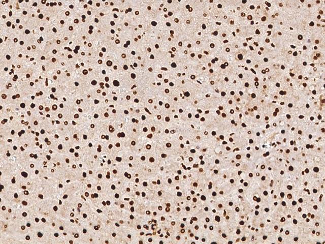 DCPS Antibody - Immunochemical staining of human DCPS in human liver with rabbit polyclonal antibody at 1:1000 dilution, formalin-fixed paraffin embedded sections.