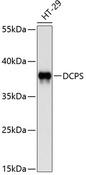 DCPS Antibody - Western blot analysis of extracts of HT-29 cells using DCPS Polyclonal Antibody at dilution of 1:1000.