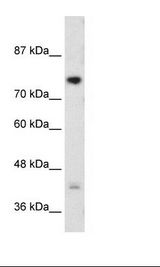 DCST1 Antibody - Jurkat Cell Lysate.  This image was taken for the unconjugated form of this product. Other forms have not been tested.