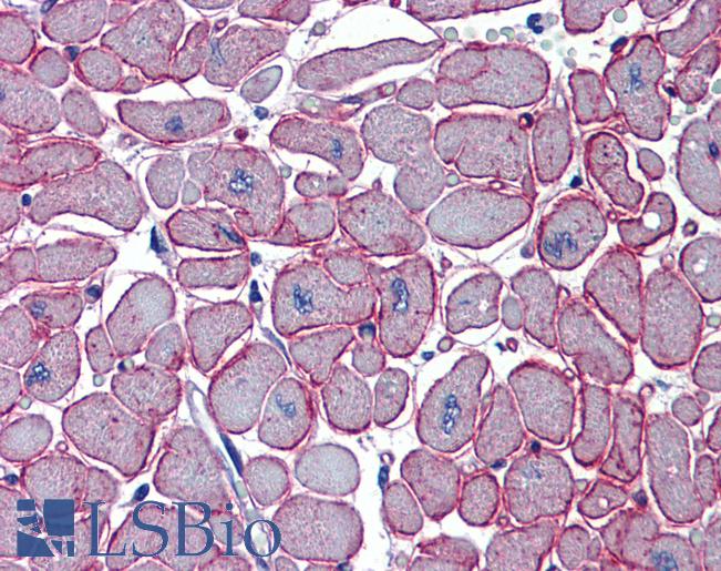 DCST1 Antibody - Anti-DCST1 antibody IHC of human heart. Immunohistochemistry of formalin-fixed, paraffin-embedded tissue after heat-induced antigen retrieval. Antibody concentration 5 ug/ml.  This image was taken for the unconjugated form of this product. Other forms have not been tested.