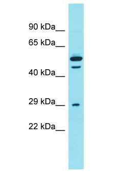 DCST2 Antibody - DCST2 antibody Western Blot of PANC1. Antibody dilution: 1 ug/ml.  This image was taken for the unconjugated form of this product. Other forms have not been tested.