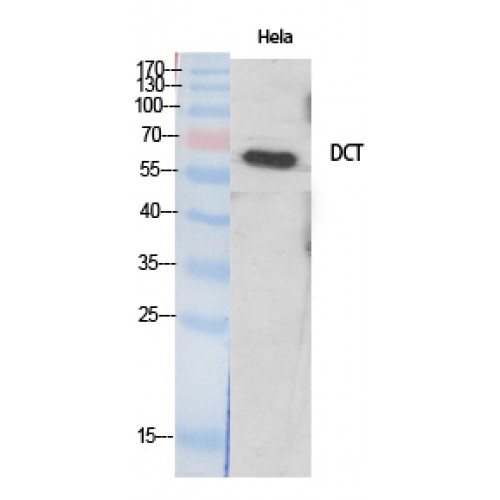 DCT / Dopachrome Tautomerase Antibody - Western blot of TRP2 antibody
