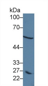 DCT / Dopachrome Tautomerase Antibody - Western Blot; Sample: Human MCF7 cell lysate; Primary Ab: 5µg/ml Rabbit Anti-Human DCT Antibody Second Ab: 0.2µg/mL HRP-Linked Caprine Anti-Rabbit IgG Polyclonal Antibody