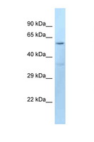 DCT / Dopachrome Tautomerase Antibody - DCT antibody Western blot of Mouse Kidney lysate. Antibody concentration 1 ug/ml.  This image was taken for the unconjugated form of this product. Other forms have not been tested.