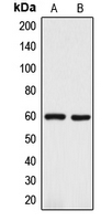 DCT / Dopachrome Tautomerase Antibody - Western blot analysis of TRP2 expression in A375 (A); Y79 (B) whole cell lysates.