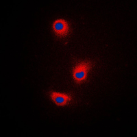 DCT / Dopachrome Tautomerase Antibody - Immunofluorescent analysis of TRP2 staining in A375 cells. Formalin-fixed cells were permeabilized with 0.1% Triton X-100 in TBS for 5-10 minutes and blocked with 3% BSA-PBS for 30 minutes at room temperature. Cells were probed with the primary antibody in 3% BSA-PBS and incubated overnight at 4 C in a humidified chamber. Cells were washed with PBST and incubated with a DyLight 594-conjugated secondary antibody (red) in PBS at room temperature in the dark. DAPI was used to stain the cell nuclei (blue).