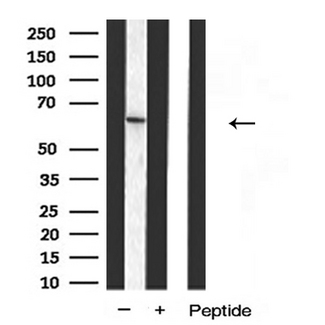 DCT / Dopachrome Tautomerase Antibody - Western blot analysis of DCT(TRP2) expression in K562 cells
