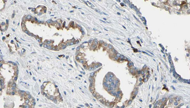 DCT / Dopachrome Tautomerase Antibody - 1:100 staining human prostate tissue by IHC-P. The sample was formaldehyde fixed and a heat mediated antigen retrieval step in citrate buffer was performed. The sample was then blocked and incubated with the antibody for 1.5 hours at 22°C. An HRP conjugated goat anti-rabbit antibody was used as the secondary.