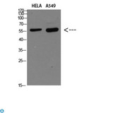 DCT / Dopachrome Tautomerase Antibody - Western blot analysis of HELA and A549 Cell Lysate, antibody was diluted at 1:1000. Secondary antibody was diluted at 1:20000.