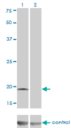 DCTD / dCMP Deaminase Antibody - Western blot of DCTD over-expressed 293 cell line, cotransfected with DCTD Validated Chimera RNAi (Lane 2) or non-transfected control (Lane 1). Blot probed with DCTD monoclonal antibody (M01), clone 4B9. GAPDH ( 36.1 kD ) used as specificity and 
