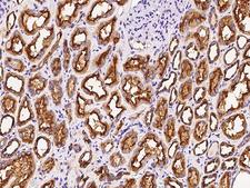 DCTD / dCMP Deaminase Antibody - Immunochemical staining DCTD in human kidney with rabbit polyclonal antibody at 1:1000 dilution, formalin-fixed paraffin embedded sections.