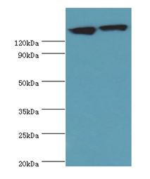 DCTN1 / Dynactin 1 Antibody - Western blot. All lanes: DCTN1 antibody at 20 ug/ml. Lane 1: mouse brain tissue. Lane 2: Jurkat whole cell lysate. Secondary antibody: Goat polyclonal to rabbit at 1:10000 dilution. Predicted band size: 142 kDa. Observed band size: 142 kDa.