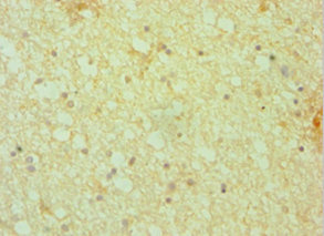 DCTN1 / Dynactin 1 Antibody - Immunohistochemistry of paraffin-embedded human brain tissue using DCTN1 Antibody at dilution of 1:100