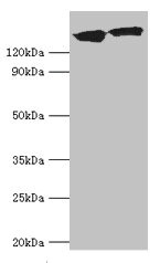 DCTN1 / Dynactin 1 Antibody - Western blot All lanes: DCTN1 antibody at 20µg/ml Lane 1: Mouse brain tissue Lane 2: Jurkat whole cell lysate Secondary Goat polyclonal to rabbit IgG at 1/10000 dilution Predicted band size: 142, 128, 137, 139, 127, 141 kDa Observed band size: 142 kDa