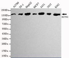 DCTN1 / Dynactin 1 Antibody - Western blot detection of DCTN1 in A2780,TF-1,HepG2,MCF7,A431&K562 cell lysate(1:1000 diluted).
