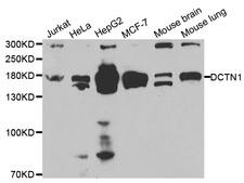 DCTN1 / Dynactin 1 Antibody - Western blot analysis of extracts of various cell lines.