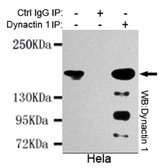 DCTN1 / Dynactin 1 Antibody - Immunoprecipitation analysis of HeLa cell lysates using Dynactin 1 mouse monoclonal antibody.