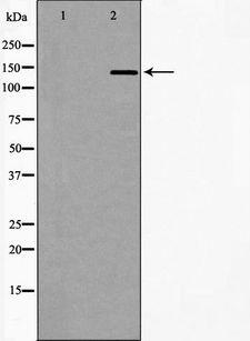 DCTN1 / Dynactin 1 Antibody - Western blot analysis of extracts of Jurkat cells using DCTN1 antibody. The lane on the left is treated with the antigen-specific peptide.