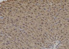 DCTN1 / Dynactin 1 Antibody - 1:100 staining mouse liver tissue by IHC-P. The sample was formaldehyde fixed and a heat mediated antigen retrieval step in citrate buffer was performed. The sample was then blocked and incubated with the antibody for 1.5 hours at 22°C. An HRP conjugated goat anti-rabbit antibody was used as the secondary.