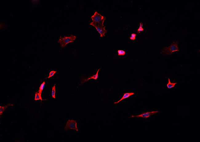 DCTN1 / Dynactin 1 Antibody - Staining HepG2 cells by IF/ICC. The samples were fixed with PFA and permeabilized in 0.1% Triton X-100, then blocked in 10% serum for 45 min at 25°C. The primary antibody was diluted at 1:200 and incubated with the sample for 1 hour at 37°C. An Alexa Fluor 594 conjugated goat anti-rabbit IgG (H+L) antibody, diluted at 1/600, was used as secondary antibody.