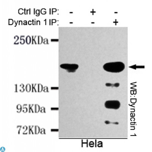 DCTN1 / Dynactin 1 Antibody - Immunoprecipitation analysis of Hela cell lysates using Dynactin 1 mouse mAb.