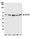 DCTN4 / Dynactin 4 Antibody - Detection of human and mouse DCTN4 by western blot. Samples: Whole cell lysate (25 µg) from HeLa, HEK293T, Jurkat, mouse TCMK-1, and mouse NIH 3T3 cells prepared using NETN lysis buffer. Antibody: Affinity purified rabbit anti-DCTN4 antibody used for WB at 0.1 µg/ml. Detection: Chemiluminescence with an exposure time of 3 minutes.