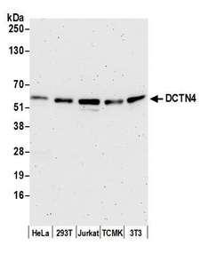 DCTN4 / Dynactin 4 Antibody - Detection of human and mouse DCTN4 by western blot. Samples: Whole cell lysate (25 µg) from HeLa, HEK293T, Jurkat, mouse TCMK-1, and mouse NIH 3T3 cells prepared using NETN lysis buffer. Antibody: Affinity purified rabbit anti-DCTN4 antibody used for WB at 0.1 µg/ml. Detection: Chemiluminescence with an exposure time of 3 minutes.